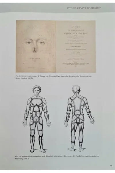 Perforator Flaps in Reconstructive Surgery / Sliesarenko S.V., Badiul P.O.