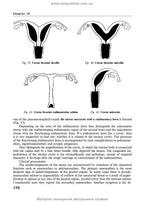 Obstetrics and Gynecology: in 2 volumes. Volume 2. Gynecology: textbook / V.I. Hryshchenko, M.O. Shcherbyna, B.M. Ventskivskyi et al. — 3rd edition