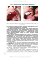 Therapeutic Dentistry: In 4 Volumes. Volume 4. Diseases of the Oral Mucosa: Textbook / M.F. Danylevsky, A.V. Borysenko, O.F. Nesin et al. — 2nd edition