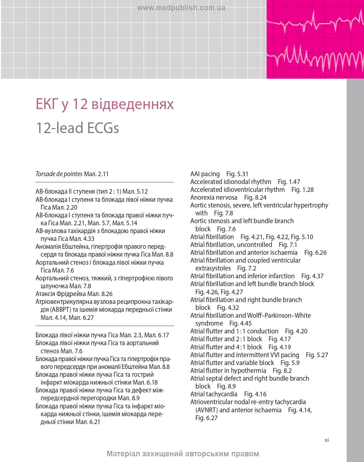 ECG Made Easy: 7th Edition / John Hampton, David Adlam (Bilingual)