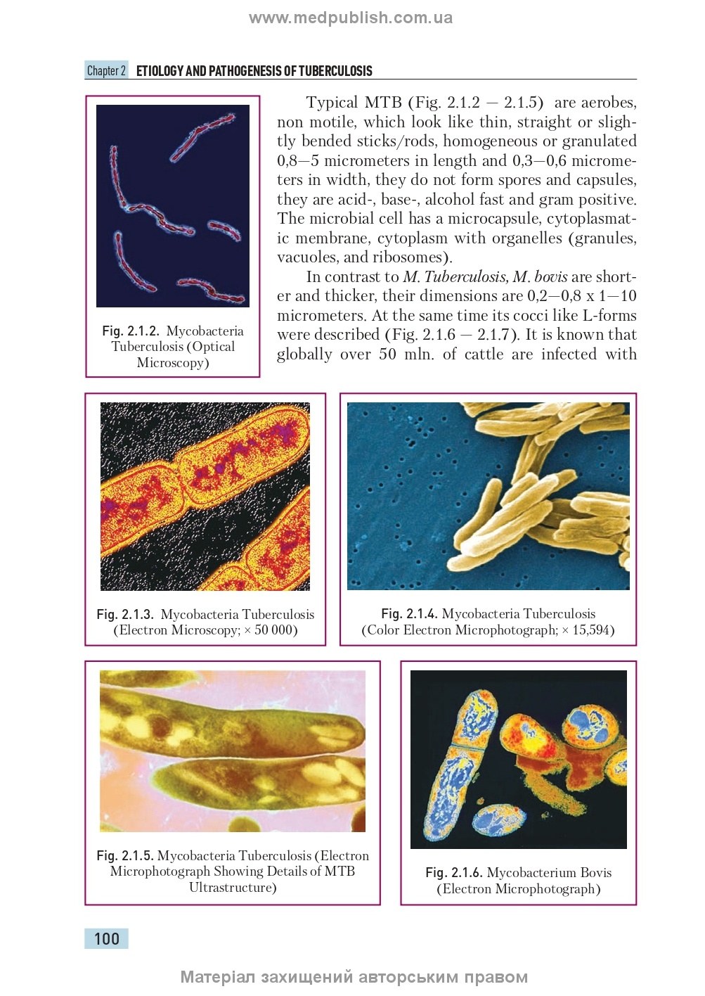 Phthisiology: textbook / V.I. Petrenko, O.K. Asmolov, M.G. Boyko et al.; edited by V.I. Petrenko. — 2nd edition