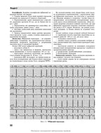 Emergency Medicine. Emergency Medical Care: Textbook / I.S. Zozulya, A.O. Volosovets, O.H. Shekera et al. — 5th edition