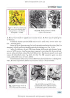 Phthisiology: textbook / V.I. Petrenko, O.K. Asmolov, M.G. Boyko et al.; edited by V.I. Petrenko. — 2nd edition