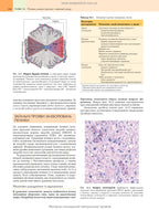 Robbins Basic Pathology: In 2 Volumes. Volume 2 / Vinay Kumar, Abul K. Abbas, Jon C. Aster; translated from the 10th English edition