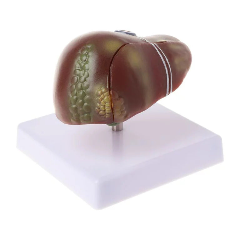 Liver model