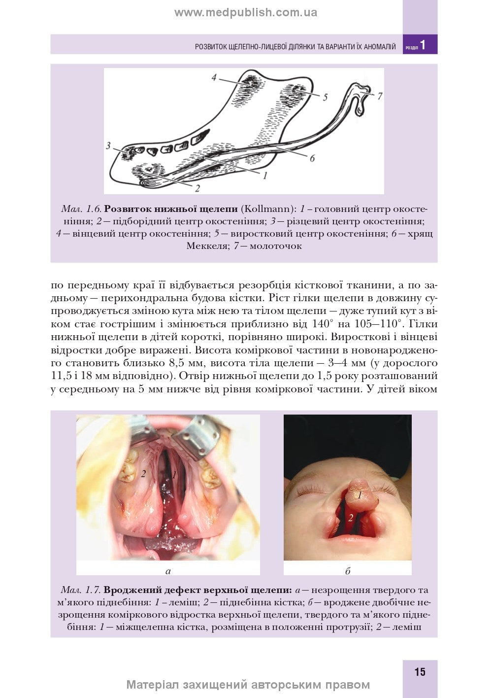 Pediatric Surgical Dentistry and Maxillofacial Surgery: Textbook / L.M. Yakovenko, V.H. Cherkasov, I.L. Chekhova et al. — 2nd edition