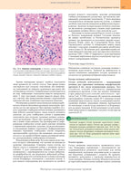 Robbins Basic Pathology: In 2 Volumes. Volume 2 / Vinay Kumar, Abul K. Abbas, Jon C. Aster; translated from the 10th English edition