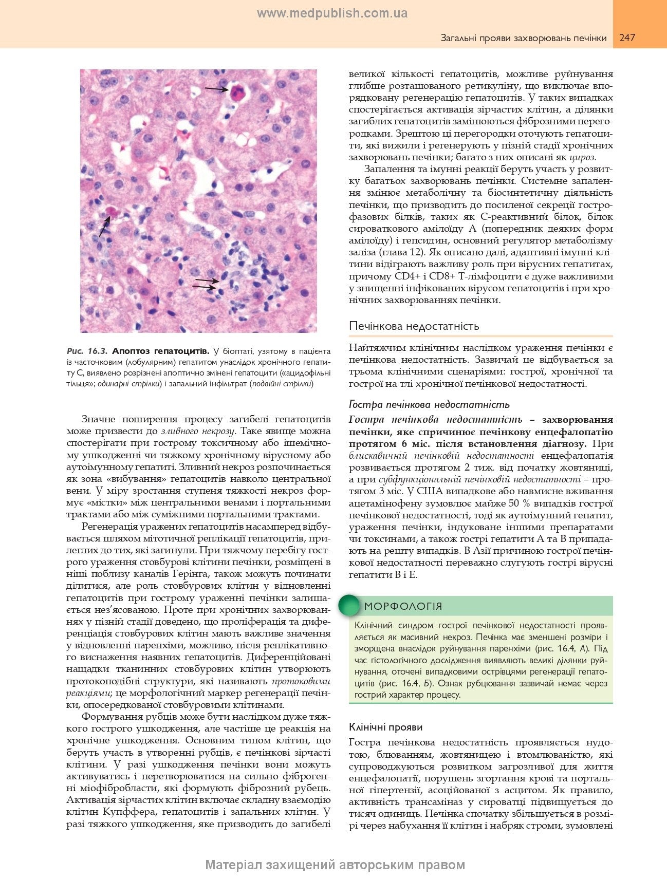 Robbins Basic Pathology: In 2 Volumes. Volume 2 / Vinay Kumar, Abul K. Abbas, Jon C. Aster; translated from the 10th English edition