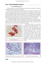 Phthisiology: textbook / V.I. Petrenko, O.K. Asmolov, M.G. Boyko et al.; edited by V.I. Petrenko. — 2nd edition