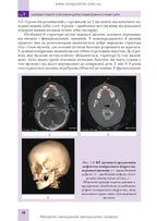 Pediatric Surgical Dentistry and Maxillofacial Surgery: Textbook / L.M. Yakovenko, V.H. Cherkasov, I.L. Chekhova et al. — 2nd edition
