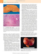 Robbins Basic Pathology: In 2 Volumes. Volume 2 / Vinay Kumar, Abul K. Abbas, Jon C. Aster; translated from the 10th English edition