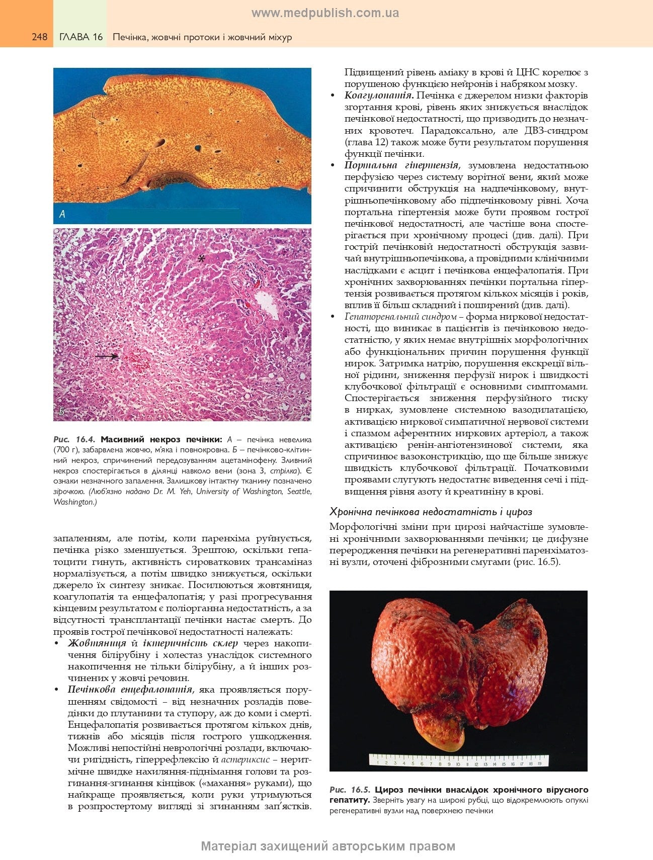 Robbins Basic Pathology: In 2 Volumes. Volume 2 / Vinay Kumar, Abul K. Abbas, Jon C. Aster; translated from the 10th English edition