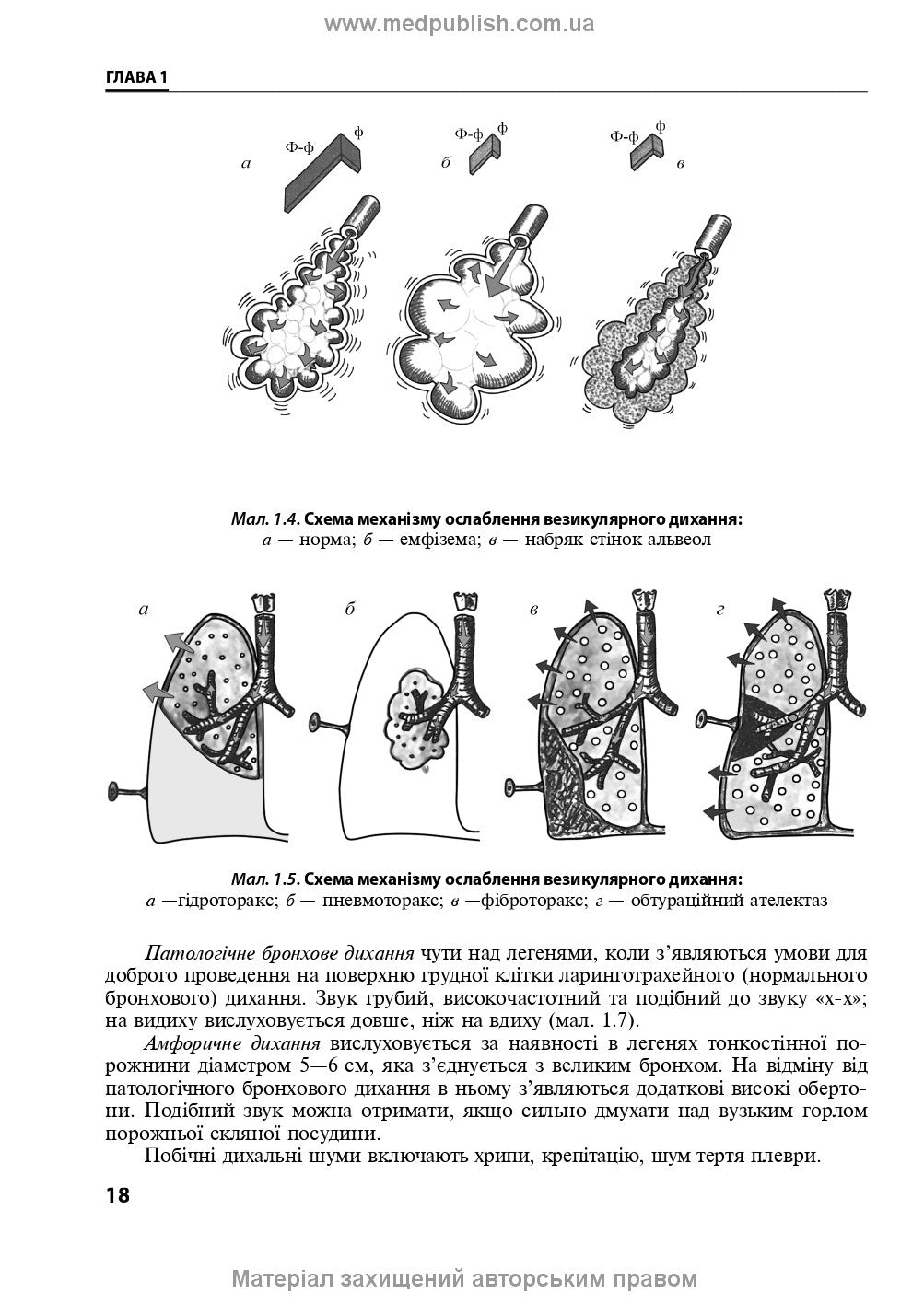 Pediatric Pulmonology: a textbook / O.L. Tsymbalista, Z.V. Vovk, N.Ya. Mytnyk et al. — 2nd edition