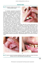 Therapeutic Dentistry: In 4 Volumes. Volume 4. Diseases of the Oral Mucosa: Textbook / M.F. Danylevsky, A.V. Borysenko, O.F. Nesin et al. — 2nd edition