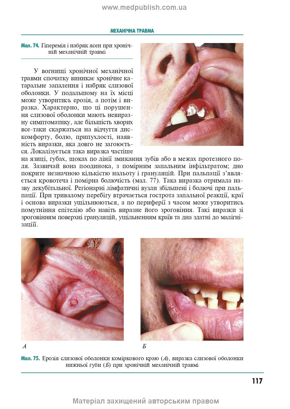 Therapeutic Dentistry: In 4 Volumes. Volume 4. Diseases of the Oral Mucosa: Textbook / M.F. Danylevsky, A.V. Borysenko, O.F. Nesin et al. — 2nd edition