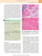 Robbins Basic Pathology: In 2 Volumes. Volume 2 / Vinay Kumar, Abul K. Abbas, Jon C. Aster; translated from the 10th English edition