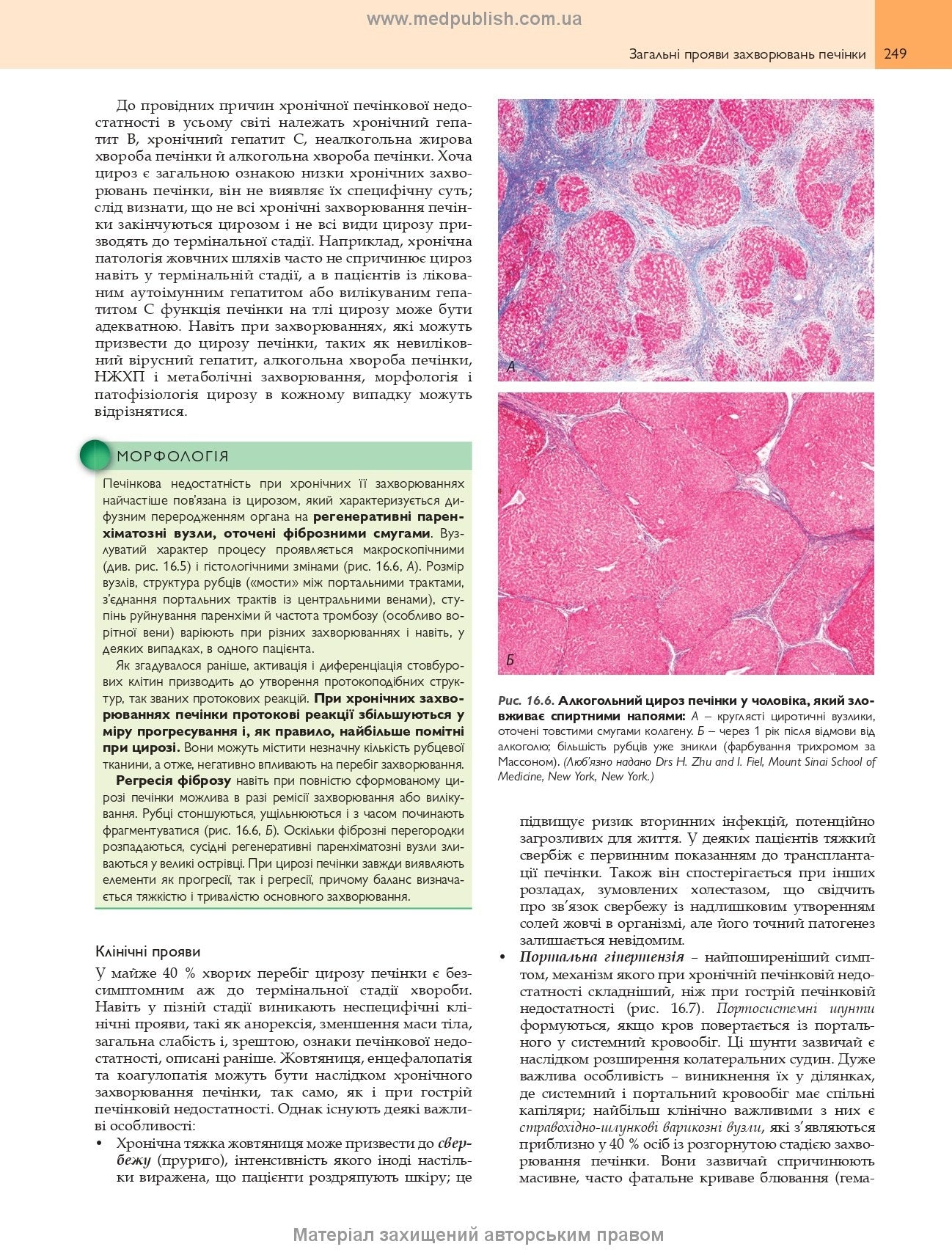 Robbins Basic Pathology: In 2 Volumes. Volume 2 / Vinay Kumar, Abul K. Abbas, Jon C. Aster; translated from the 10th English edition