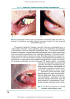 Therapeutic Dentistry: In 4 Volumes. Volume 4. Diseases of the Oral Mucosa: Textbook / M.F. Danylevsky, A.V. Borysenko, O.F. Nesin et al. — 2nd edition