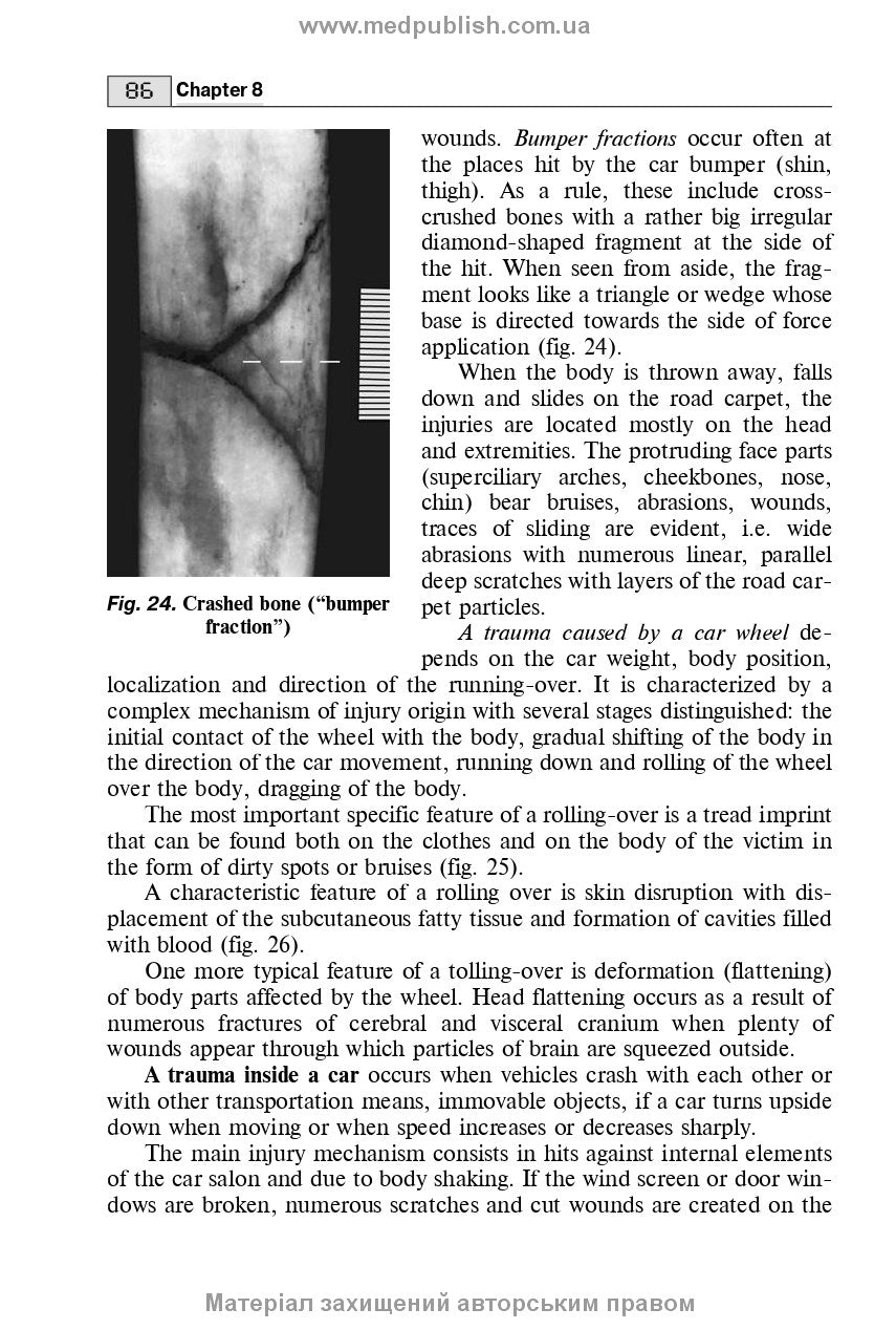 Forensic Medicine: textbook / B.V. Mykhailychenko, A.M. Biliakov, I.G. Savka. — 3rd edition