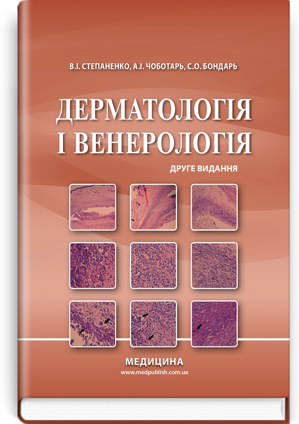 Dermatology and Venereology: textbook / V.I. Stepanenko, A.I. Chobotar, S.O. Bondar et al. — 2nd edition
