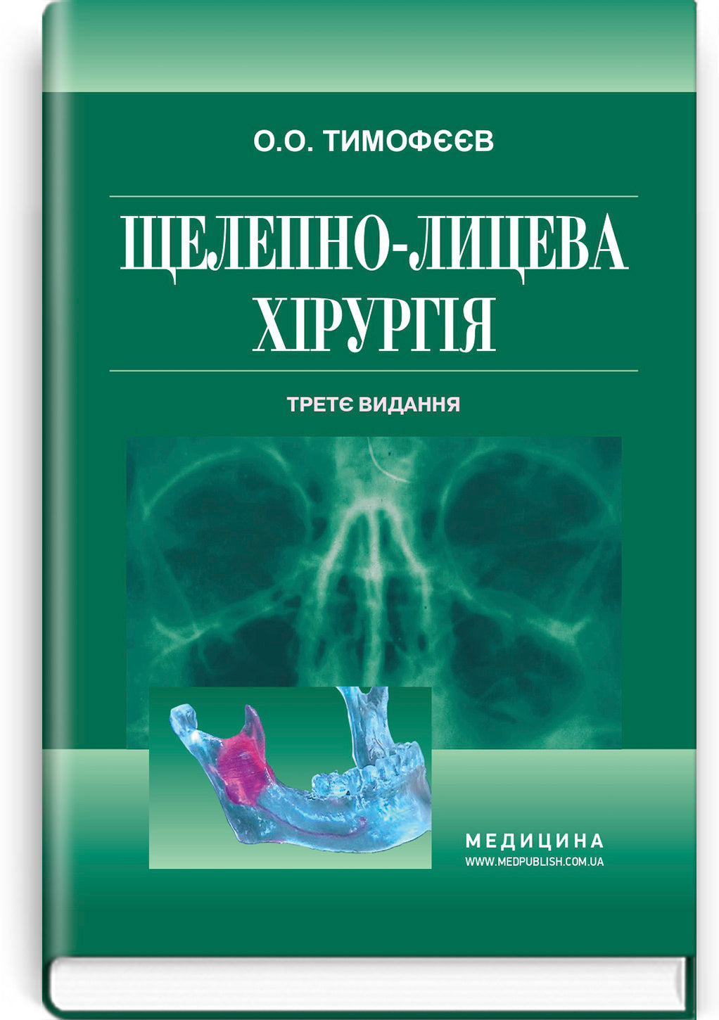 Maxillofacial Surgery: a textbook / O.O. Tymofieiev. — 3rd edition