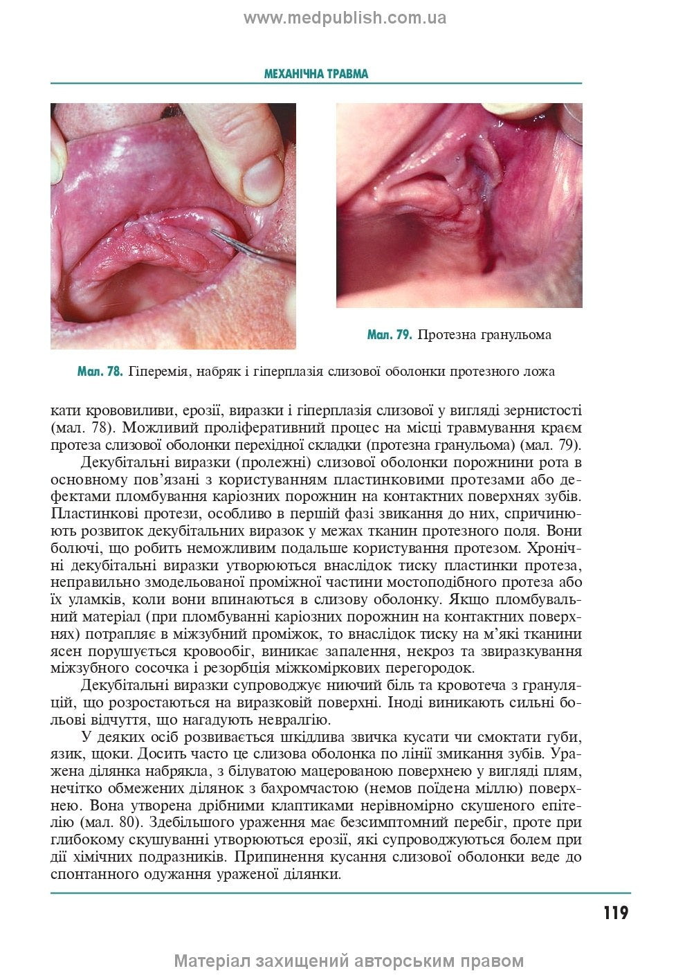 Therapeutic Dentistry: In 4 Volumes. Volume 4. Diseases of the Oral Mucosa: Textbook / M.F. Danylevsky, A.V. Borysenko, O.F. Nesin et al. — 2nd edition