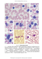 Clinical Laboratory Diagnostics: A Textbook / L. Ye. Lapovets, H. B. Lebid, O. O. Yastremska et al. — 2nd Edition