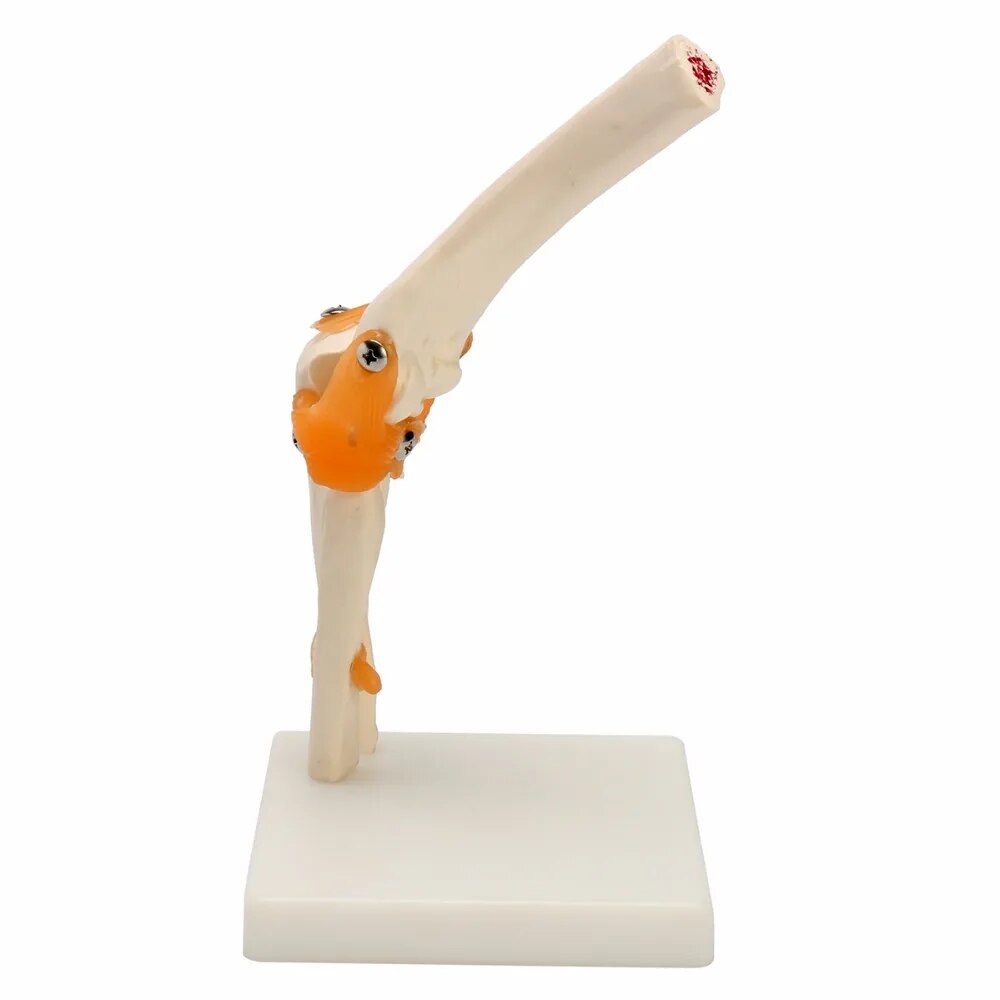Elbow joint model