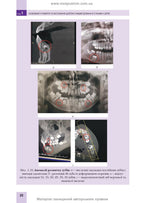 Pediatric Surgical Dentistry and Maxillofacial Surgery: Textbook / L.M. Yakovenko, V.H. Cherkasov, I.L. Chekhova et al. — 2nd edition