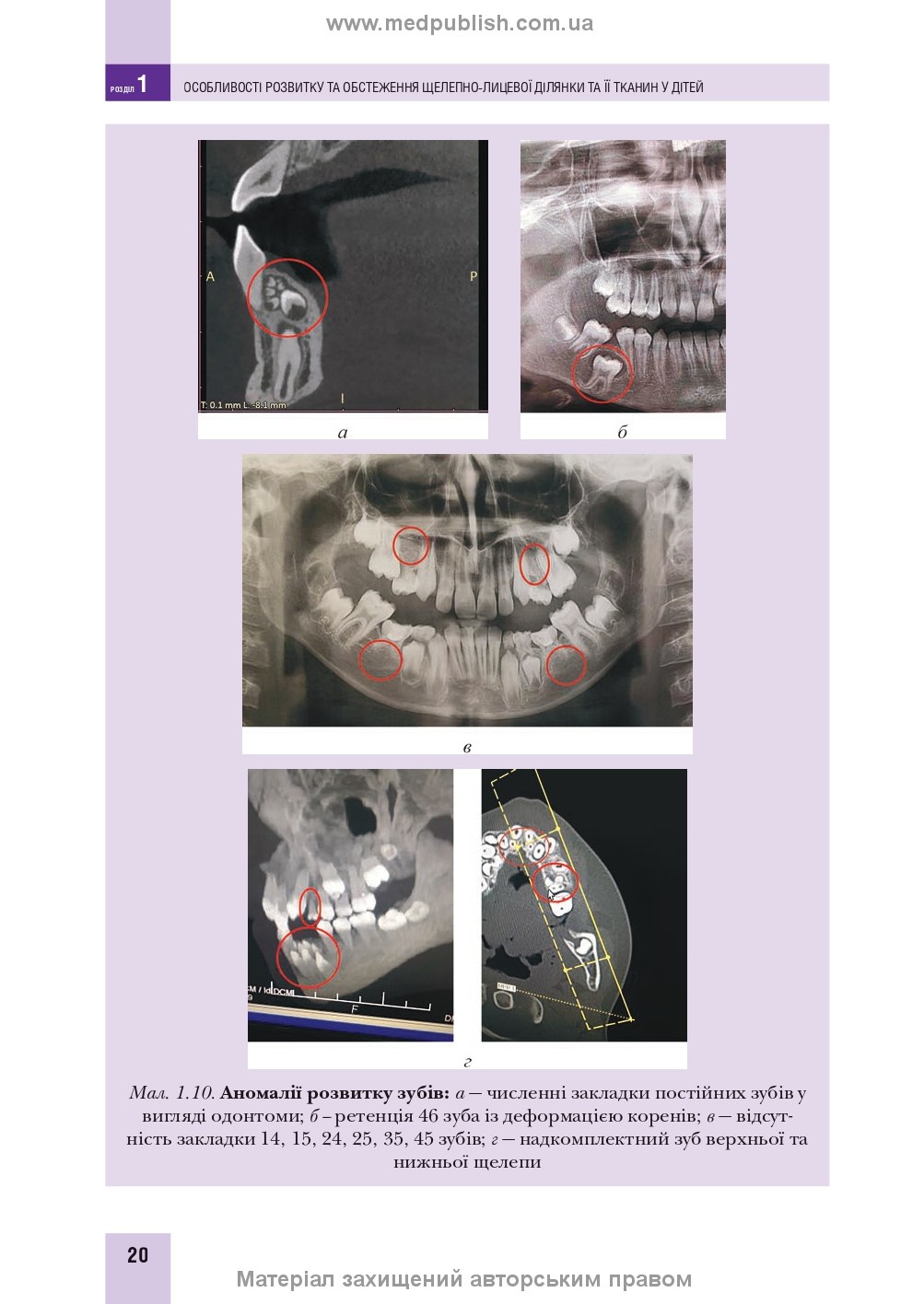 Pediatric Surgical Dentistry and Maxillofacial Surgery: Textbook / L.M. Yakovenko, V.H. Cherkasov, I.L. Chekhova et al. — 2nd edition
