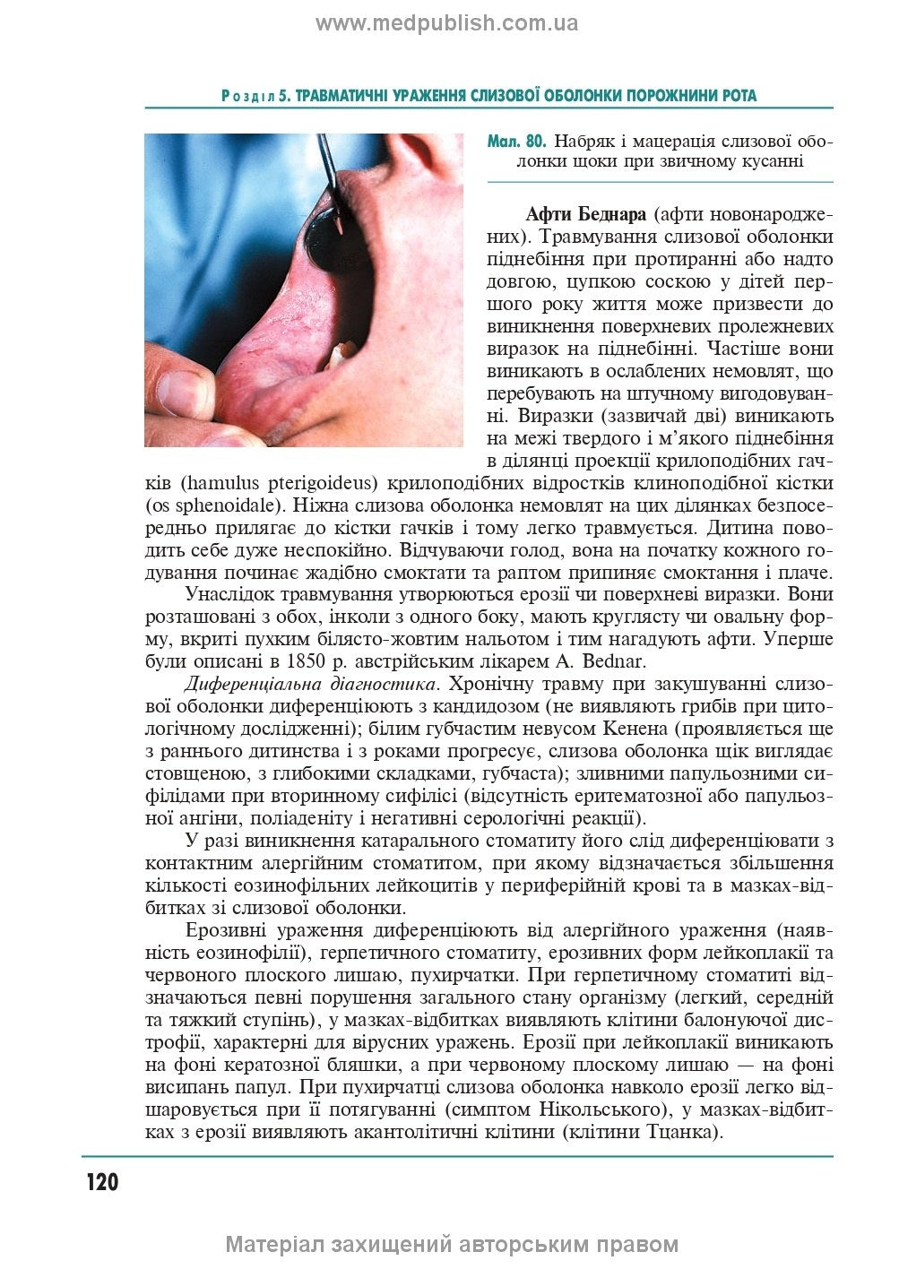 Therapeutic Dentistry: In 4 Volumes. Volume 4. Diseases of the Oral Mucosa: Textbook / M.F. Danylevsky, A.V. Borysenko, O.F. Nesin et al. — 2nd edition