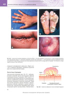 Medical Microbiology. A Guide to Microbial Infections: Pathogenesis, Immunity, Laboratory Diagnosis and Control: 19th Edition: in 2 volumes. Volume 2 / Michael R. Barer, Will Irving, Andrew Swann, Nelun Perera