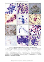 Clinical Laboratory Diagnostics: A Textbook / L. Ye. Lapovets, H. B. Lebid, O. O. Yastremska et al. — 2nd Edition