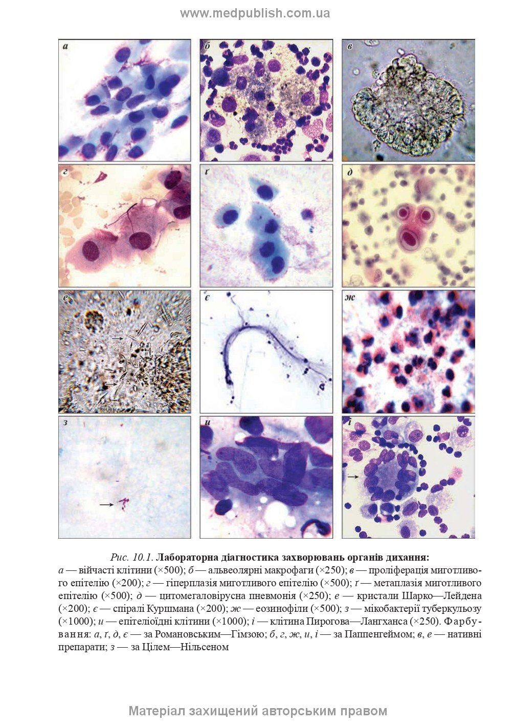 Clinical Laboratory Diagnostics: A Textbook / L. Ye. Lapovets, H. B. Lebid, O. O. Yastremska et al. — 2nd Edition