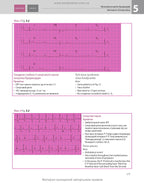 ECG Made Easy: 7th Edition / John Hampton, David Adlam (Bilingual)
