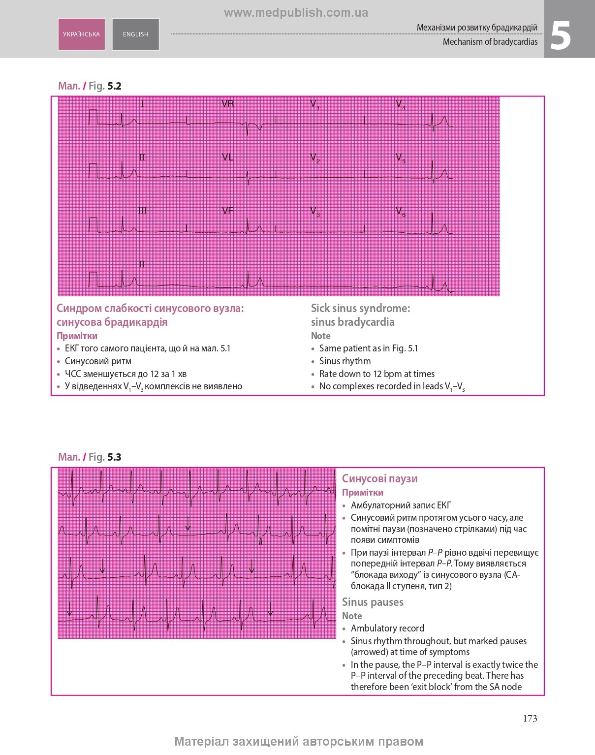 ECG Made Easy: 7th Edition / John Hampton, David Adlam (Bilingual)
