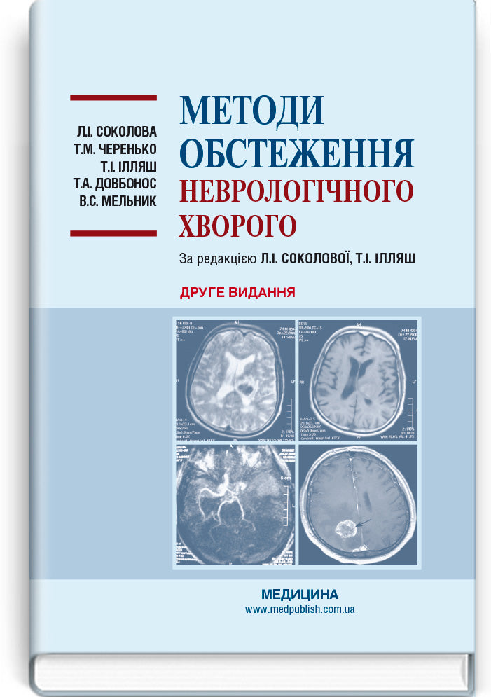 Methods of Neurological Examination: Study Guide / L.I. Sokolova, T.M. Cherenko, T.I. Illiash et al. — 2nd edition