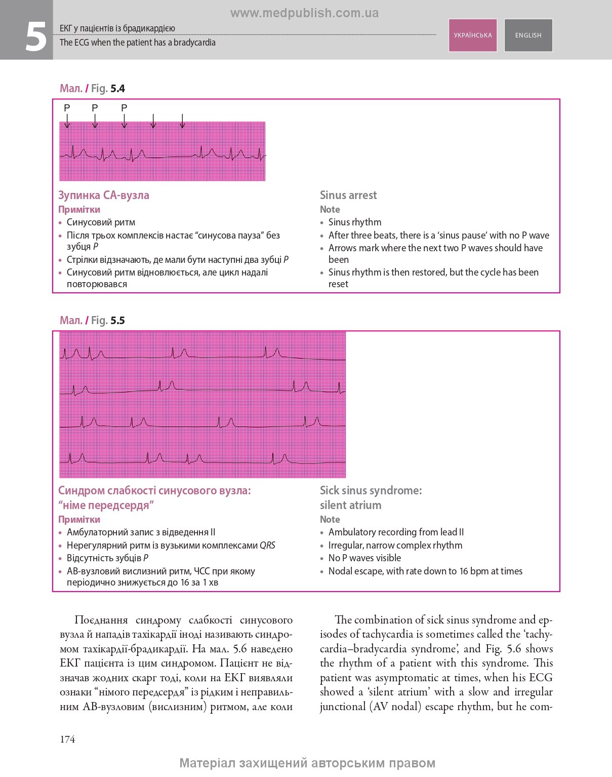 ECG Made Easy: 7th Edition / John Hampton, David Adlam (Bilingual)