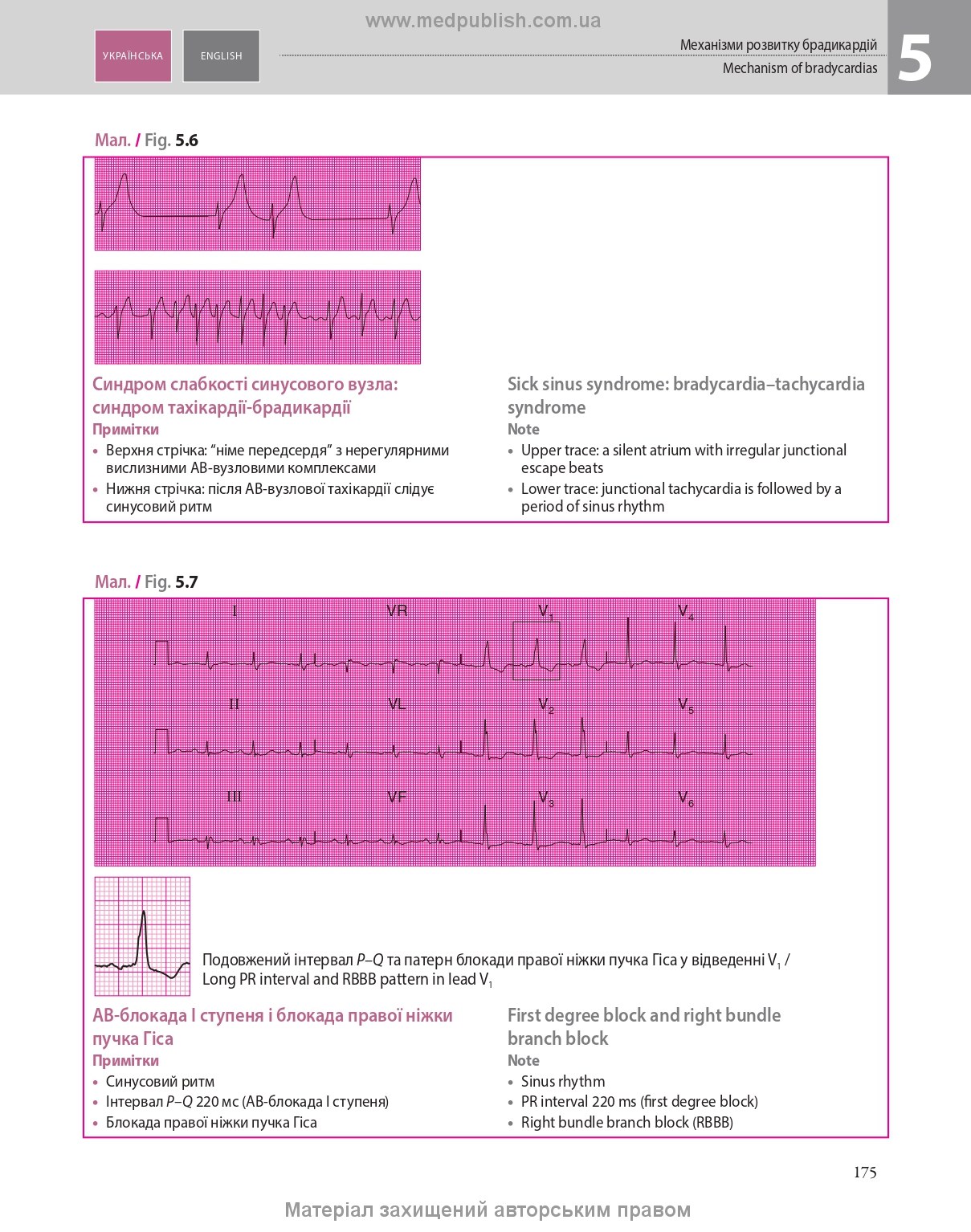 ECG Made Easy: 7th Edition / John Hampton, David Adlam (Bilingual)