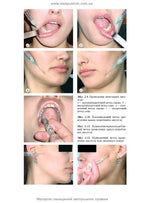 Maxillofacial Surgery: a textbook / O.O. Tymofieiev. — 3rd edition