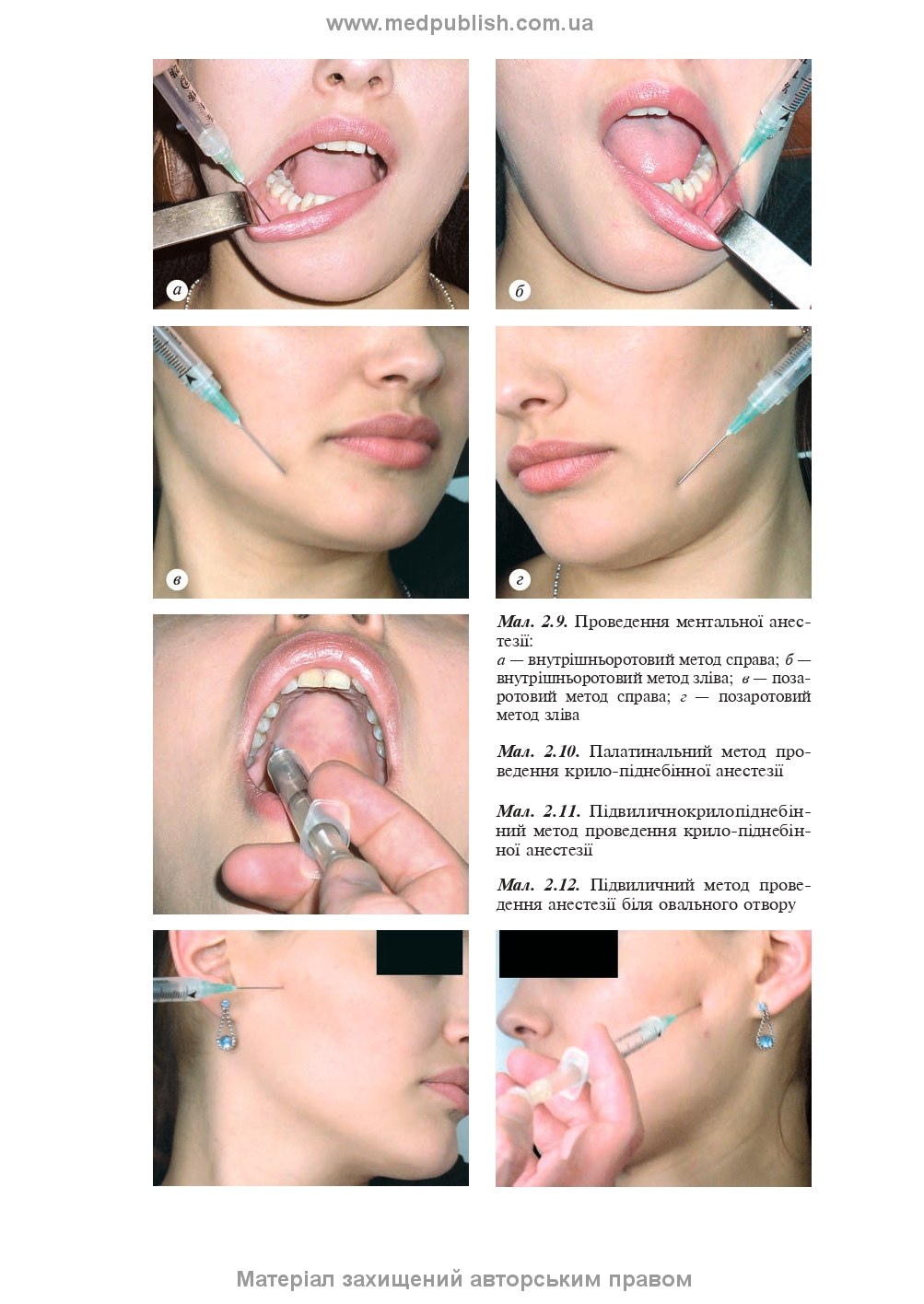 Maxillofacial Surgery: a textbook / O.O. Tymofieiev. — 3rd edition