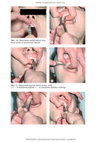 Maxillofacial Surgery: a textbook / O.O. Tymofieiev. — 3rd edition