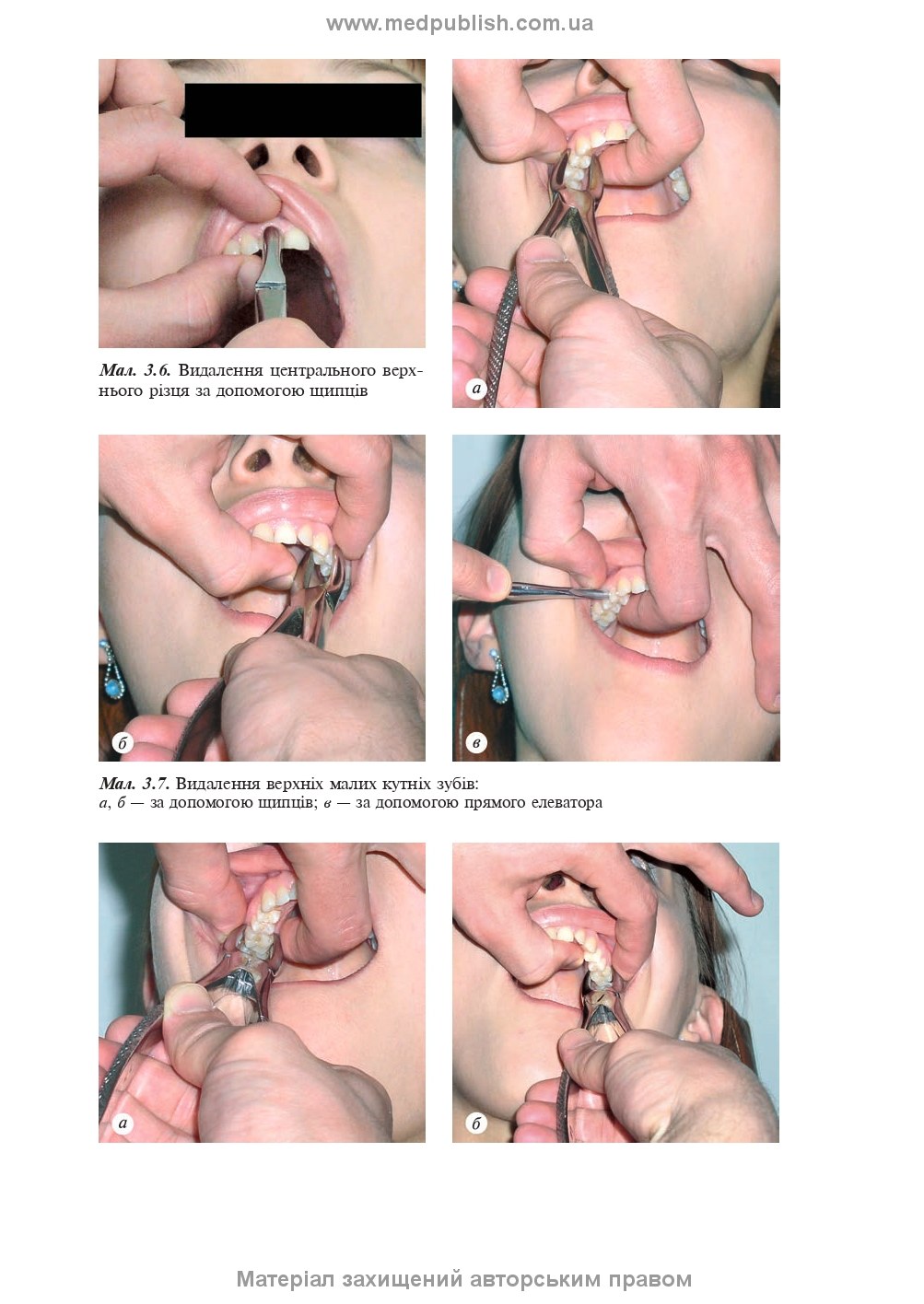 Maxillofacial Surgery: a textbook / O.O. Tymofieiev. — 3rd edition