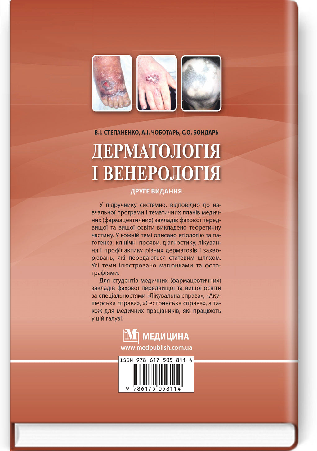 Dermatology and Venereology: textbook / V.I. Stepanenko, A.I. Chobotar, S.O. Bondar et al. — 2nd edition
