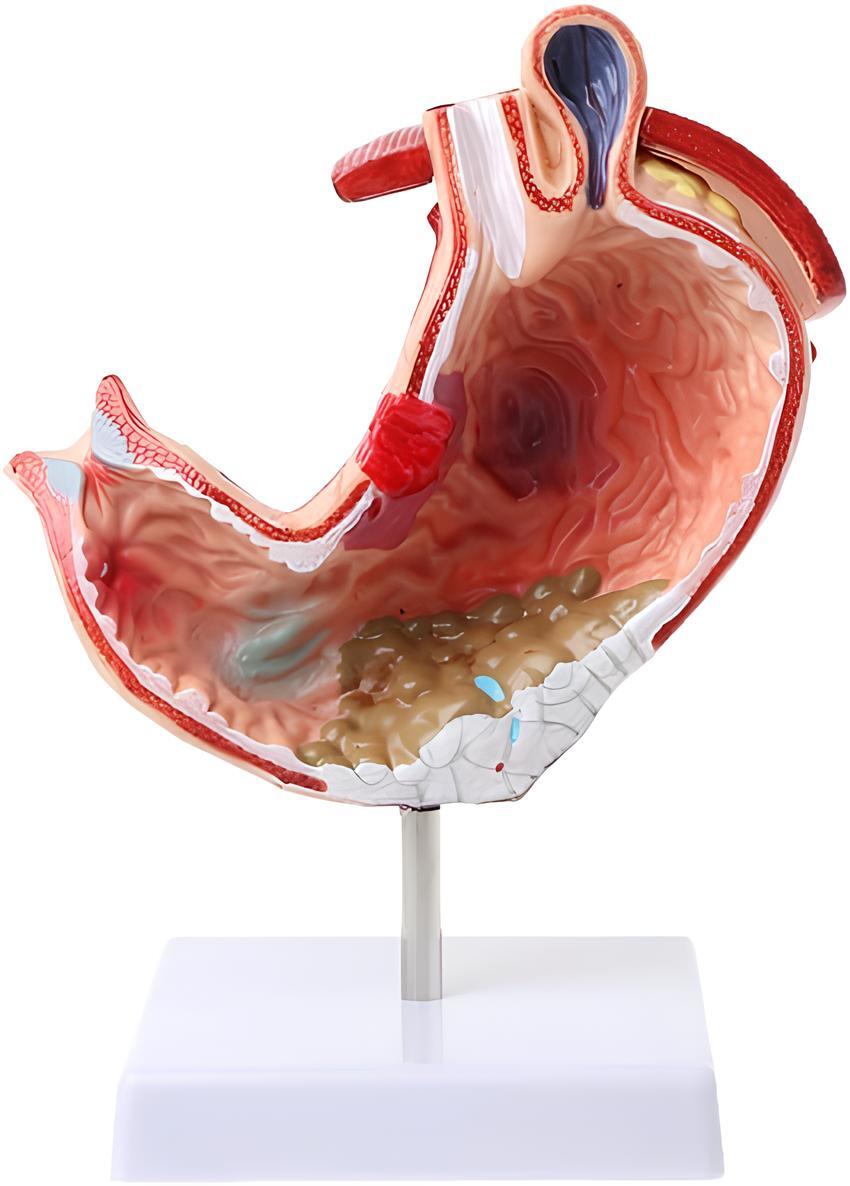 Stomach model
