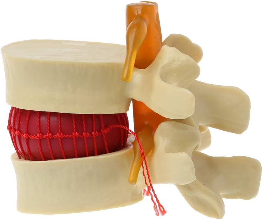 Intervertebral disc model
