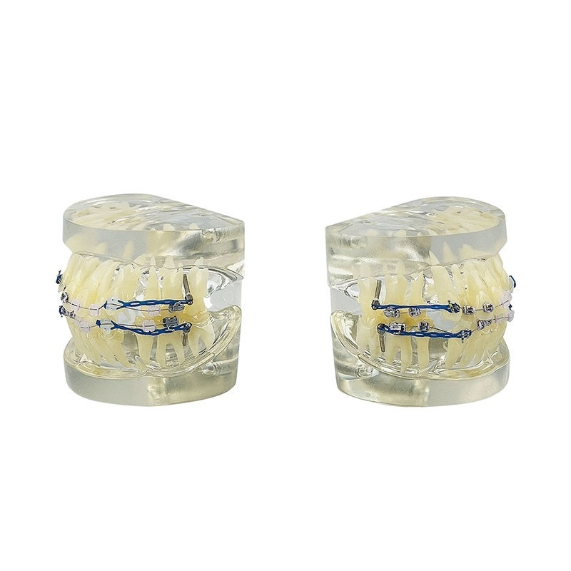 Teeth model with braces