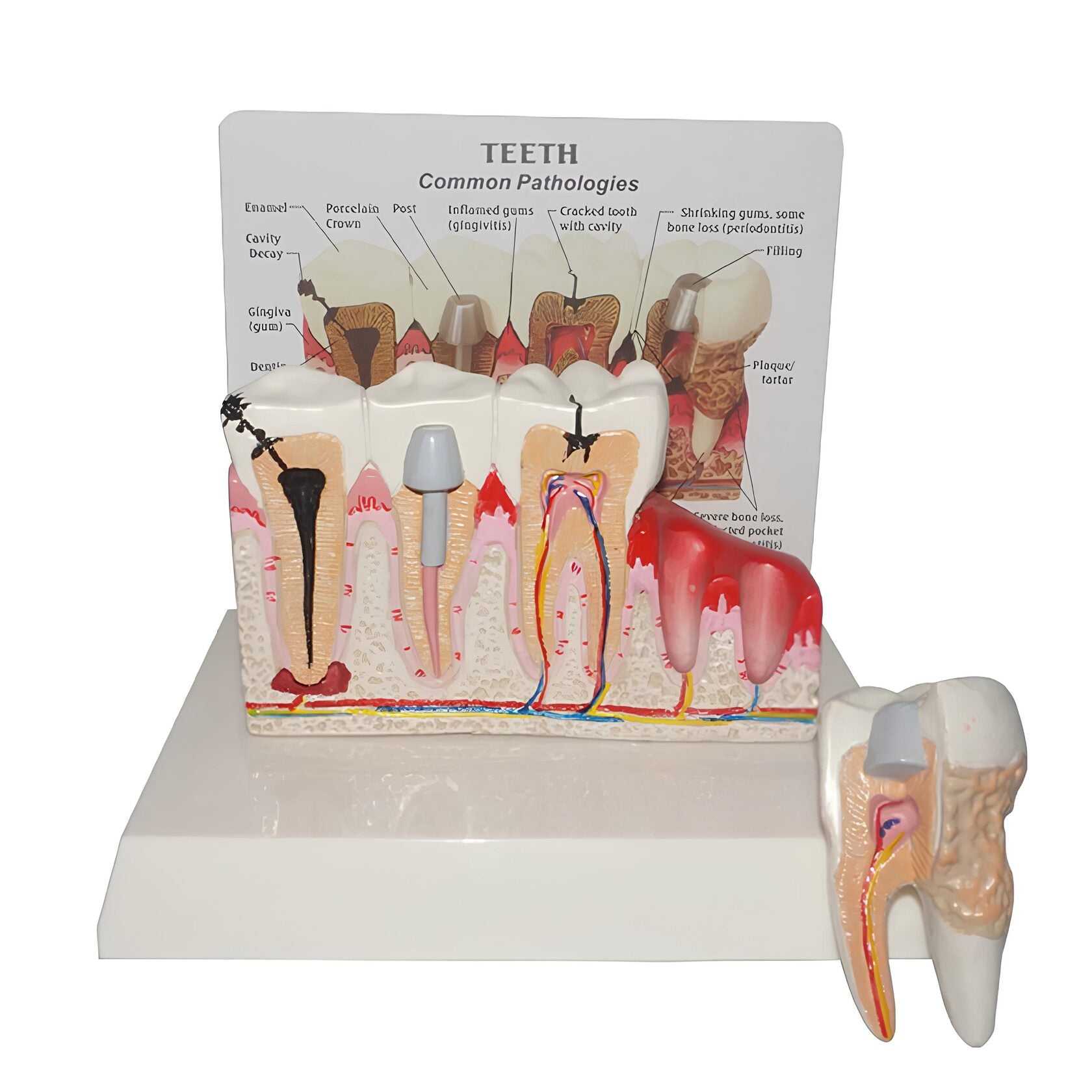 Anatomical model of a tooth row