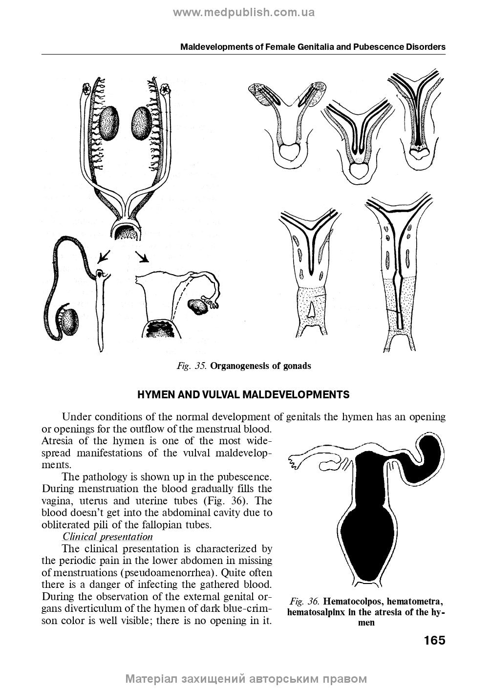 Obstetrics and Gynecology: in 2 volumes. Volume 2. Gynecology: textbook / V.I. Hryshchenko, M.O. Shcherbyna, B.M. Ventskivskyi et al. — 3rd edition