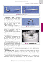 Prosthetic Dentistry: textbook / M.M. Rozhko, V.P. Nespriadko, I.V. Paliichuk et al.